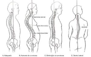 Coluna vertebral e suas curvaturas - normal e patológicas